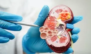 Huyết áp cao - 'kẻ giết người thầm lặng' hủy hoại thận